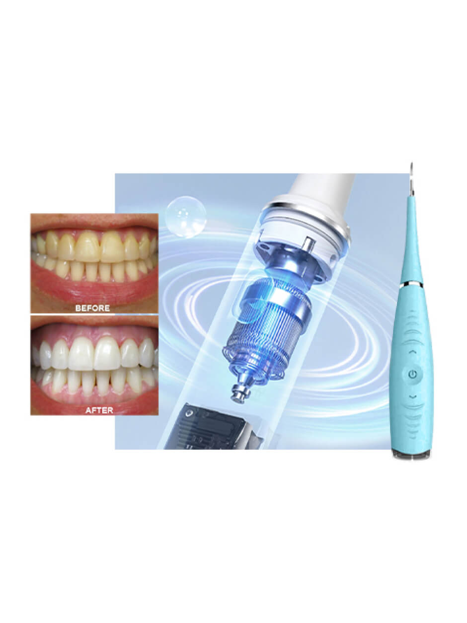 Teeth Cleaner